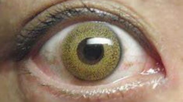 There are several types of contact lenses colored, soft and many more. Everything about contact lenses is very precised.