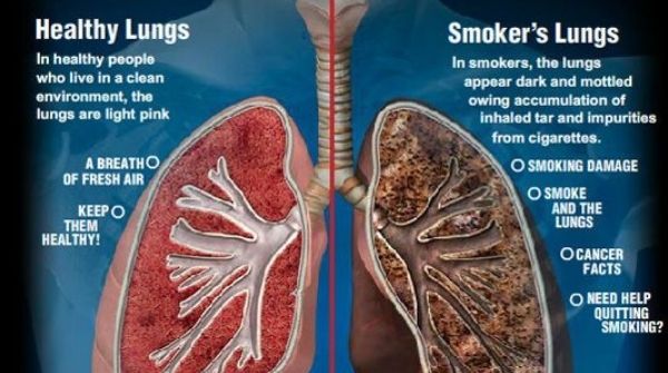 The harmful ill effect caused by smoking is, it will prone to infections which will lead to chronic lung diseases.