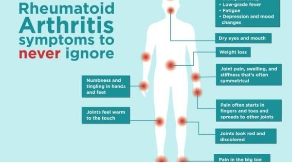Rheumatoid arthritis will cause painful inflammation in the joints of the hands and legs.