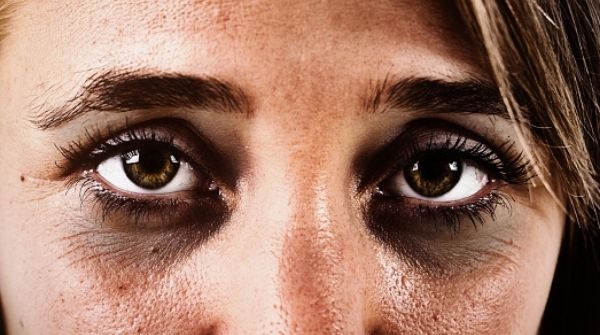 Lack of sleep & poor sleep hygiene is cause of dark circles. So, this is how you are getting them.