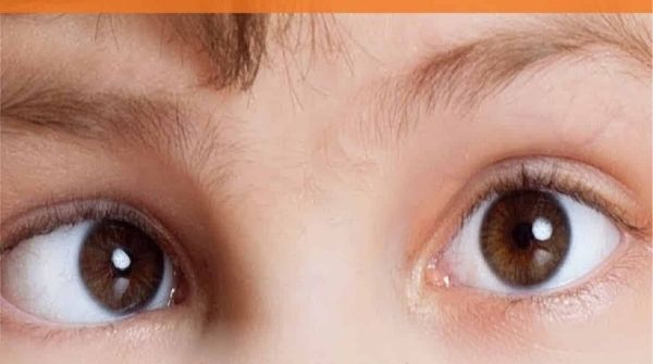 Children will get affected by amblyopia and the symptoms of an eye, are tilting the head, squinting, etc.