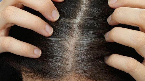 Olive oil for hair is extremely good as it hydrate your roots and keep your scalp healthy.